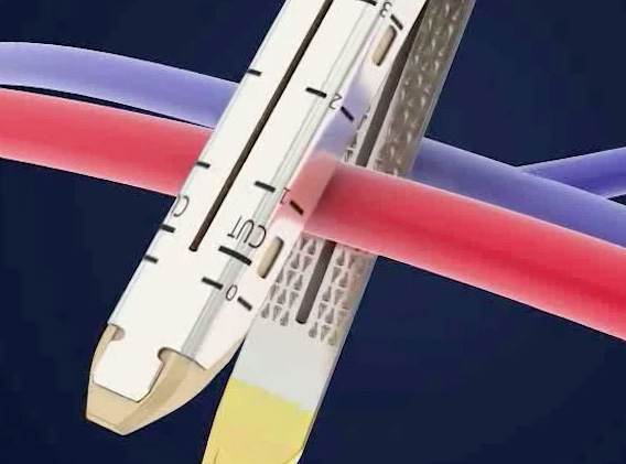 医疗器械吻合器3D演示动画